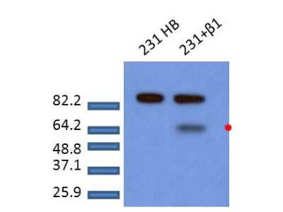 Western Blot: Smad2 [p Ser465, p Ser467] Antibody [NBP2-44217]